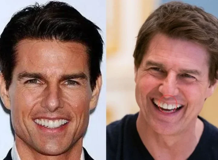 Tom Cruise Teeth