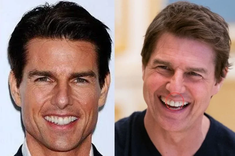 Tom Cruise Teeth